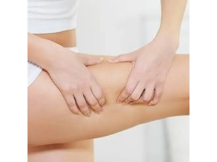 cellulite