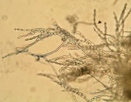 Fungo microscopio