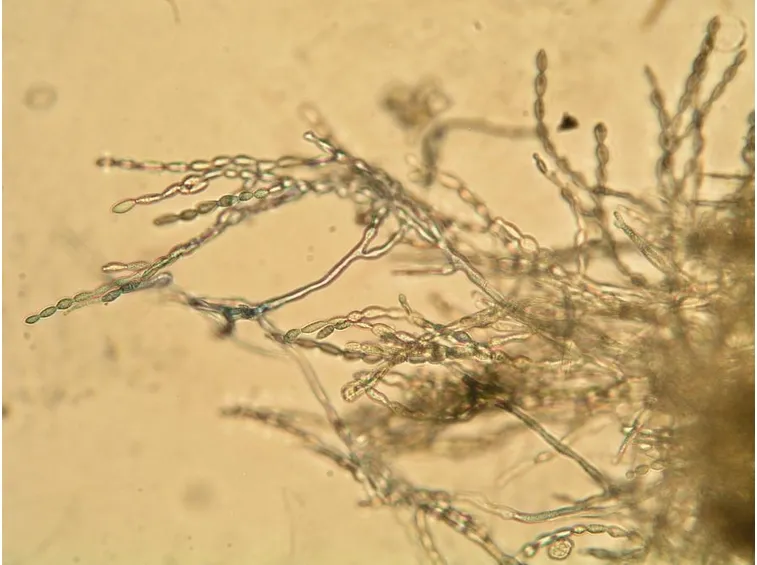 Fungo microscopio